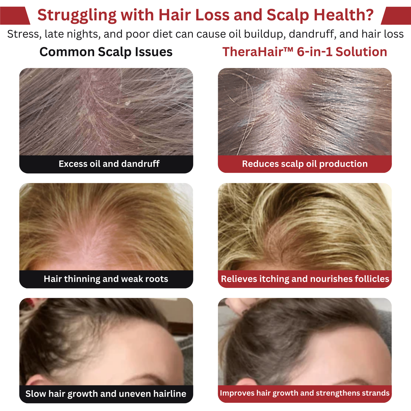 TheraHair™ – Terapeutisk hovedbundskam – Rødt lys, afslappende massage & Serumdiffuser (💧Gratis serum inkluderet!)