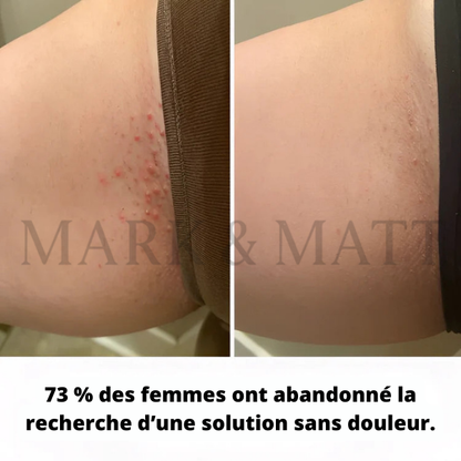 SilkTrim™ Pro – Rasoir Électrique Waterproof pour Femmes