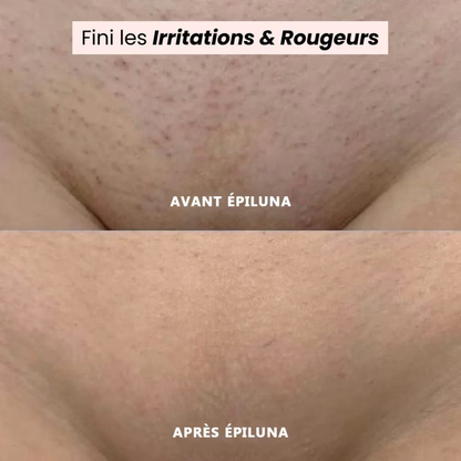 SilkTrim™ Pro – Rasoir Électrique Waterproof pour Femmes