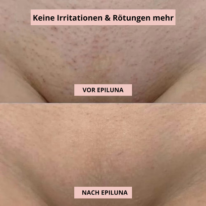 SilkTrim™ Pro – Elektrischer Waterproof-Rasierer für Frauen