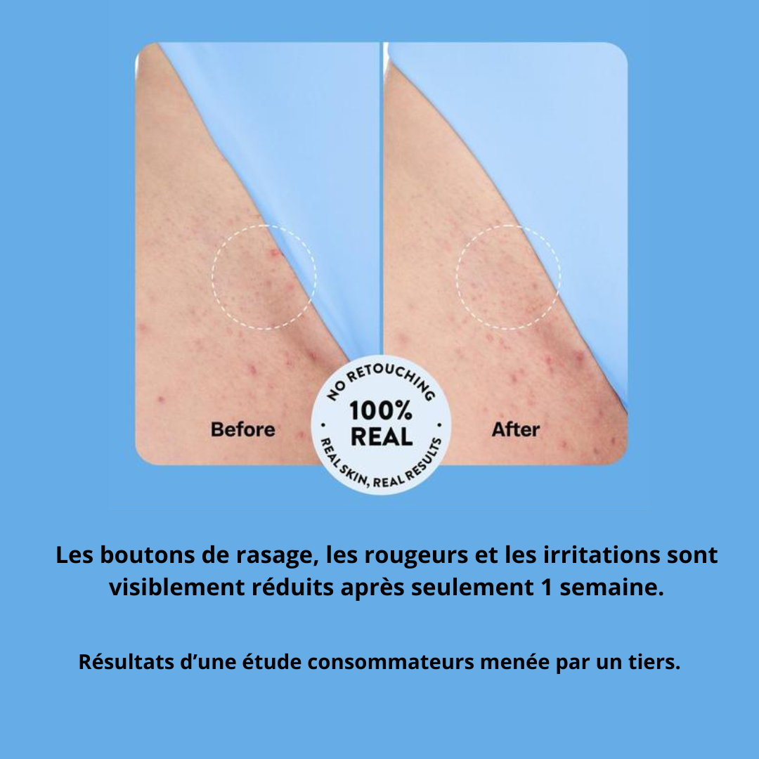 GlowHer Roll-On – Achetez-en 1, obtenez-en 1 GRATUIT