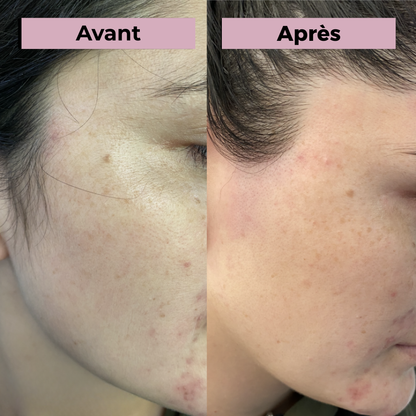 GlowHer Roll-On – Achetez-en 1, obtenez-en 1 GRATUIT