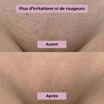 GlowHer Roll-On – Achetez-en 1, obtenez-en 1 GRATUIT