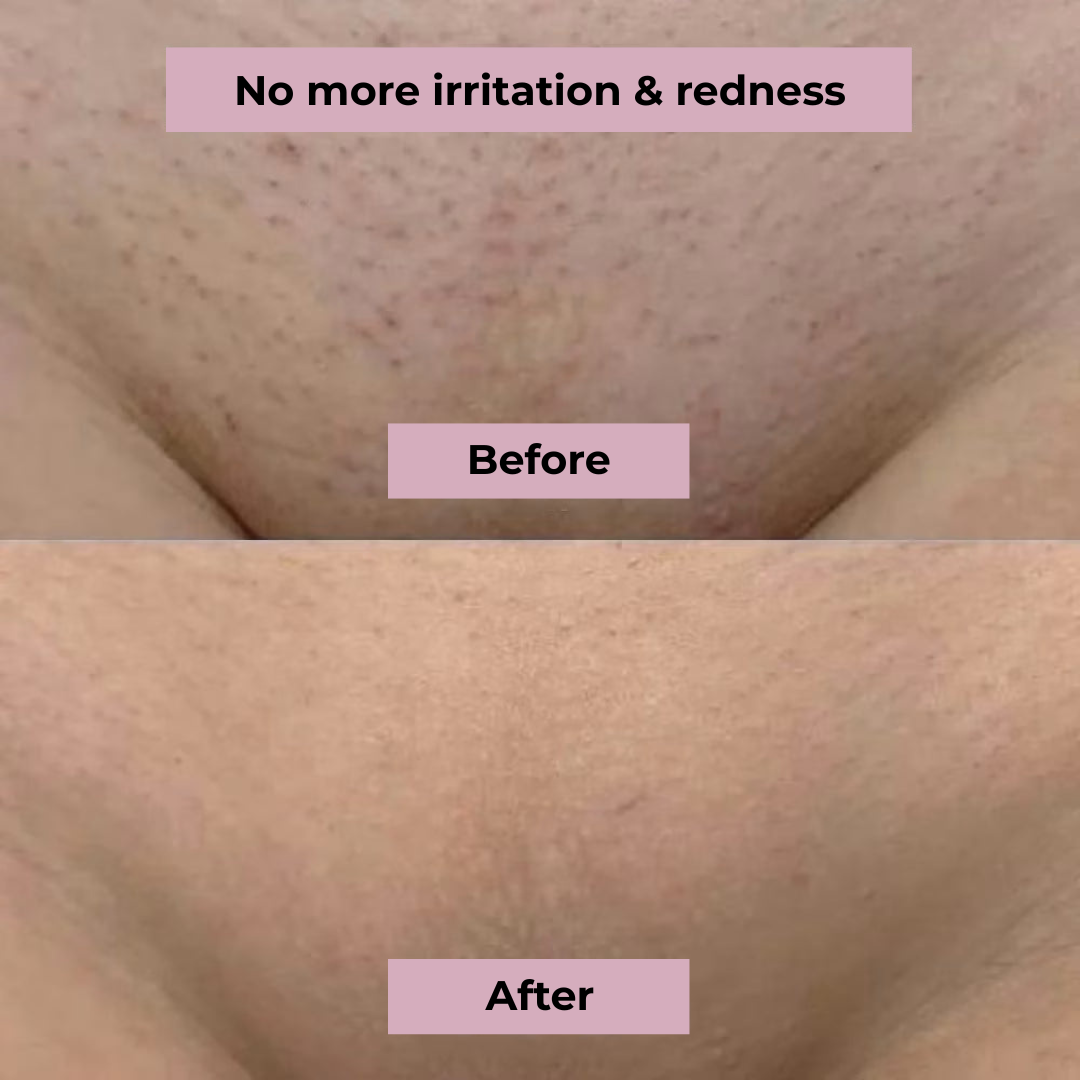 SilkTrim™ Pro – Women’s Waterproof Electric Shaver