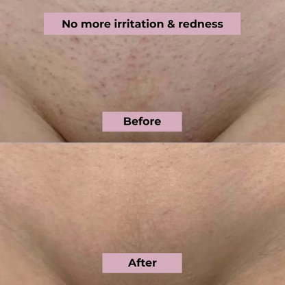 SilkTrim™ Pro – Women’s Waterproof Electric Shaver