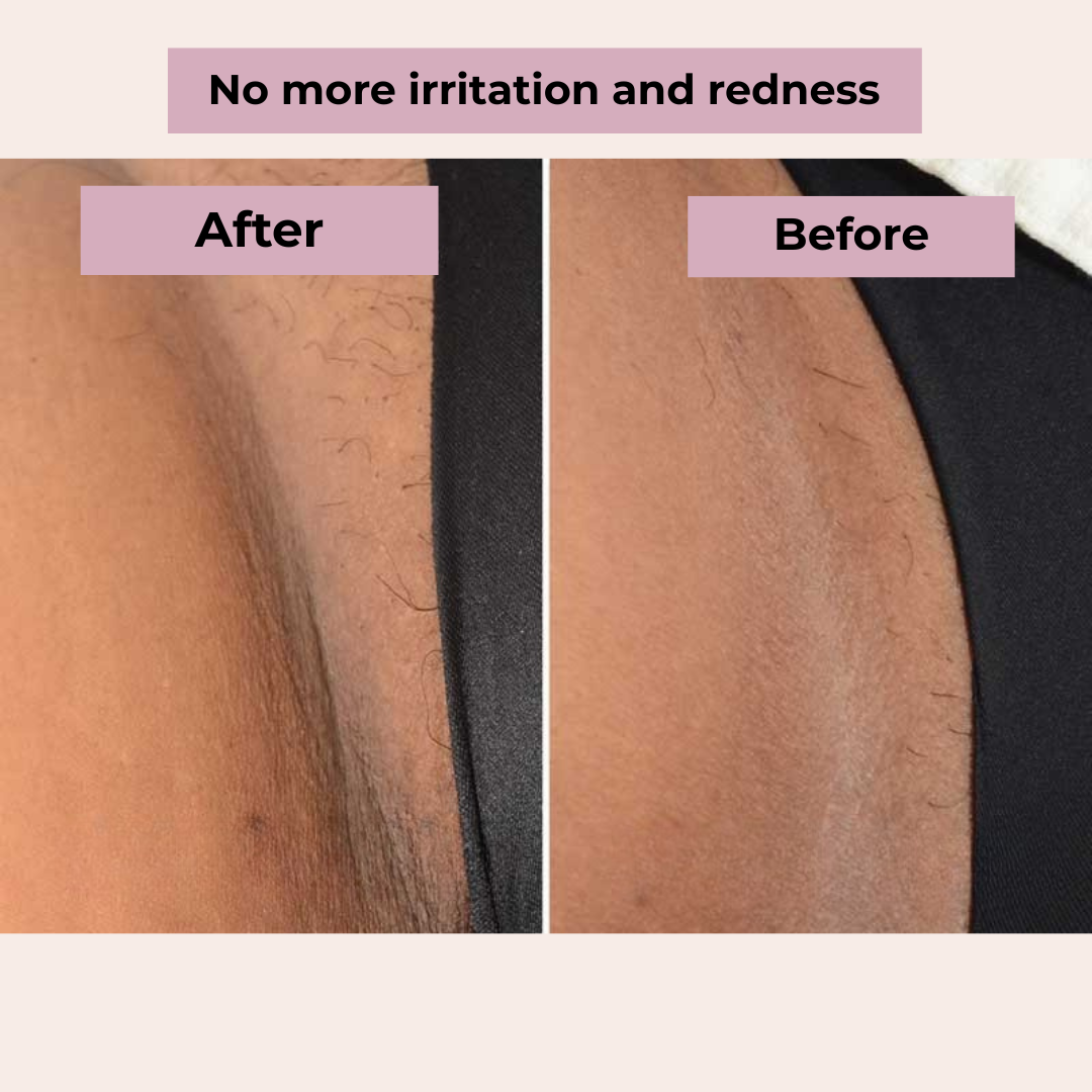 SilkTrim™ Pro – Women’s Waterproof Electric Shaver