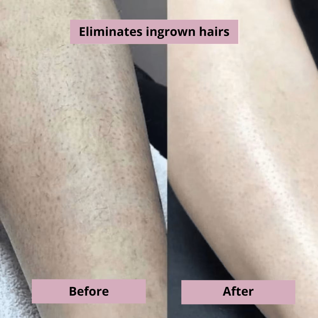 SilkTrim™ Pro – Women’s Waterproof Electric Shaver