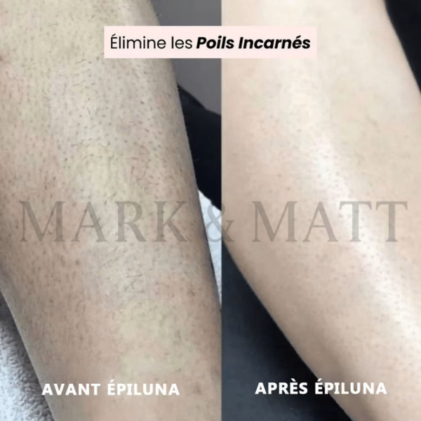 SilkTrim™ Pro – Rasoir Électrique Waterproof pour Femmes