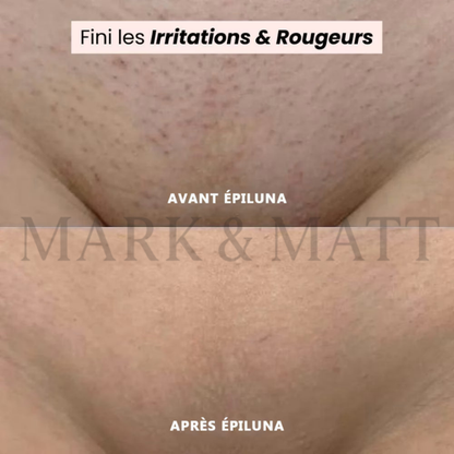 SilkTrim™ Pro – Rasoir Électrique Waterproof pour Femmes